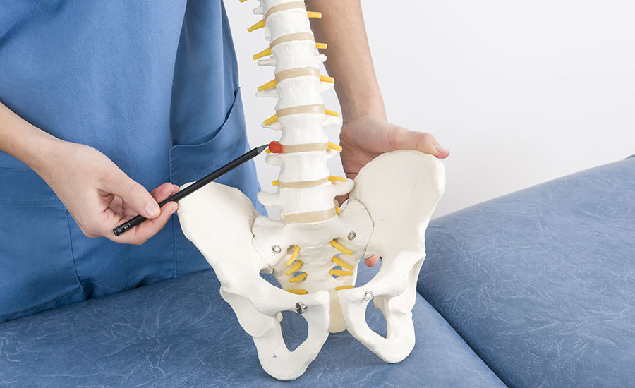 A doctor showing the location of a herniated disc
