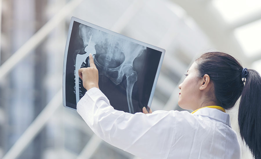 Doctor checking an X-ray of a hip